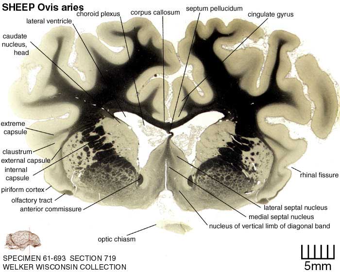 Atlas of the Sheep Brain > Section Image