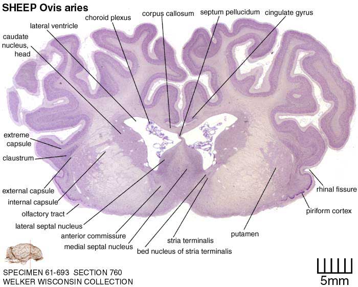 Atlas of the Sheep Brain > Section Image